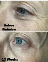 Load image into Gallery viewer, Minimiser Rollerball